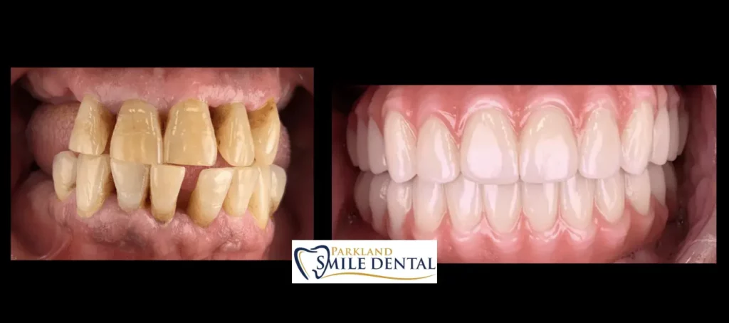 - Parkland Smile Dental