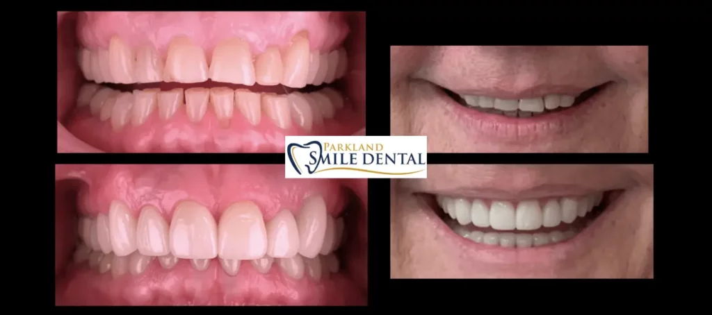 - Parkland Smile Dental