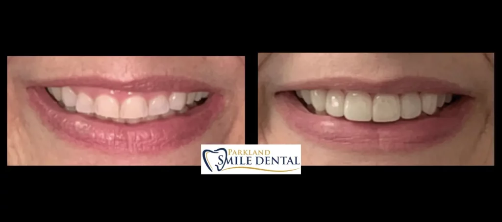 - Parkland Smile Dental