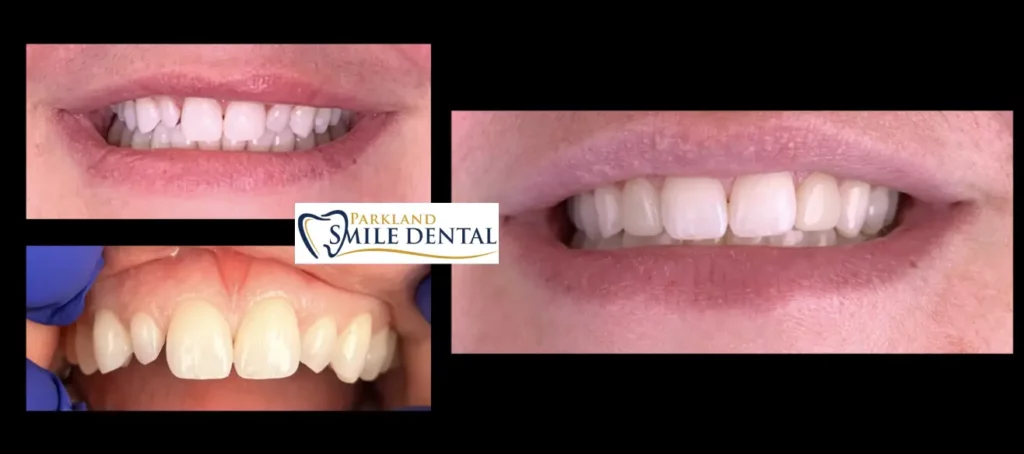- Parkland Smile Dental
