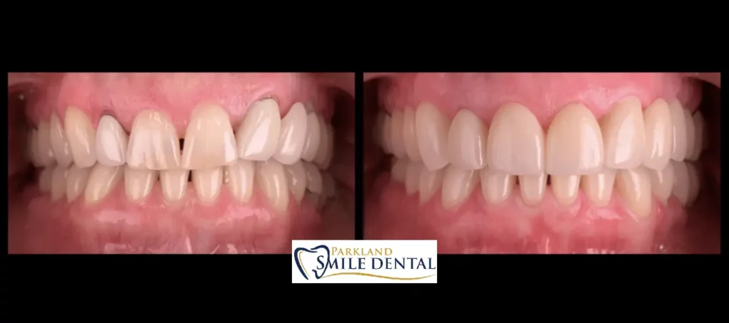 - Parkland Smile Dental